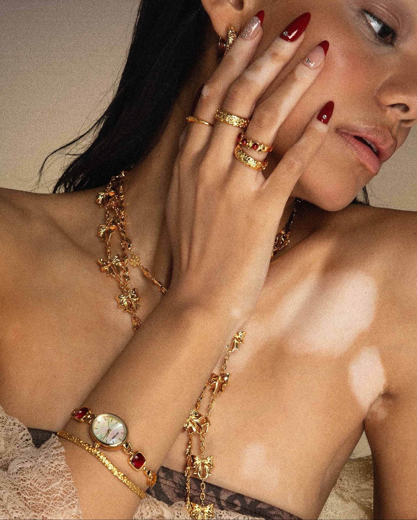 Serenade of Orchid Ring